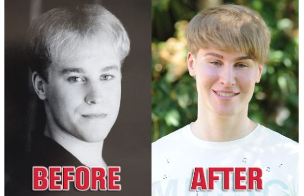 Man spends 100 grand to look like Justin Bieber.